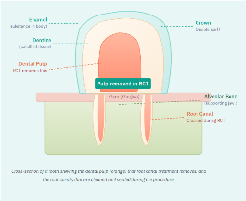 What Is Root Canal Treatment