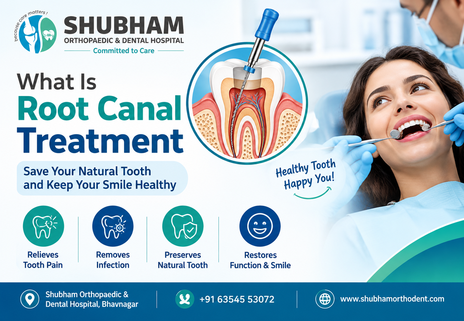 What Is Root Canal Treatment